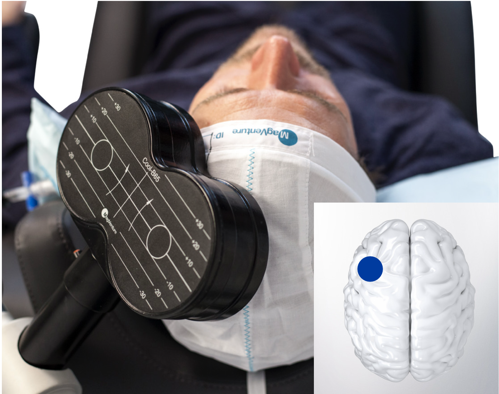 MagVenture TMS System